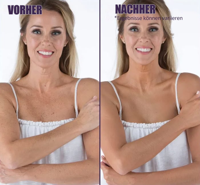 ✨Concealer – 3 in 1Body Coverage Perfector 💧 Leicht und wasserfest