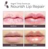 DEROL™ LIP PLUMPER KIT