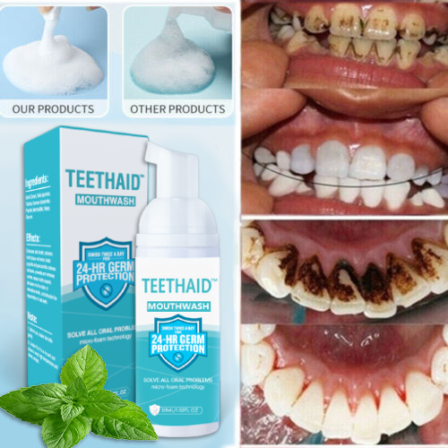 (🔥Last Day Promotion - 70% Off)🔥Mouthwash, Calculus Removal, Teeth Whitening-BUY 2 GET 1 FREE&FREE SHIPPING TODAY🎁