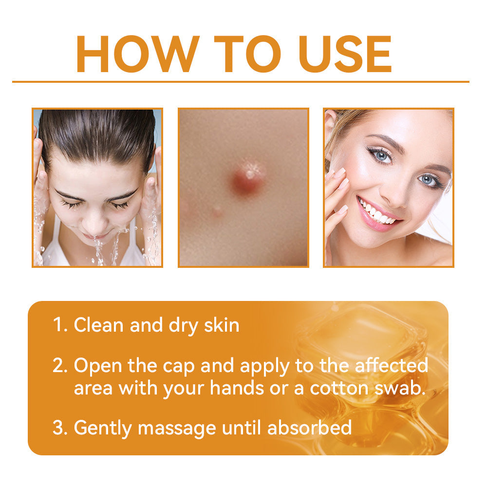 BENDCHARGE™ Bee Essence Skin Treatment Cream (AAD Recommended👨‍⚕️)