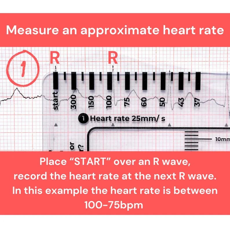 (🌲Early Christmas Sale- 49% OFF) ECG 7 Step Ruler - ECG Assessment Tool