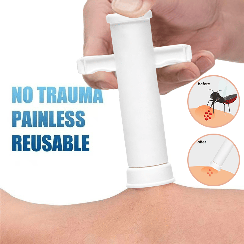 🎁TikTok Last Day Sale - 70% OFF🔥Bug Bite Suction Tool🦟 - Relieve itching and swelling✅