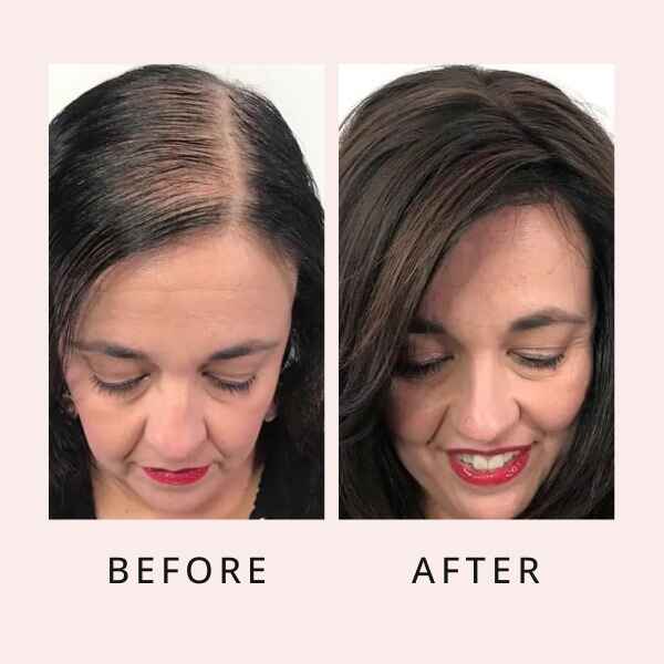 🔥Last Day Promotion 50% OFF🔥Hair Growth Serum