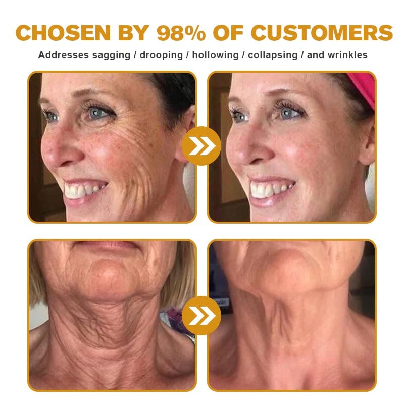 🔥Last Day Discount: 70% OFF - Upgraded Instant Wrinkle Eye Tightener cream