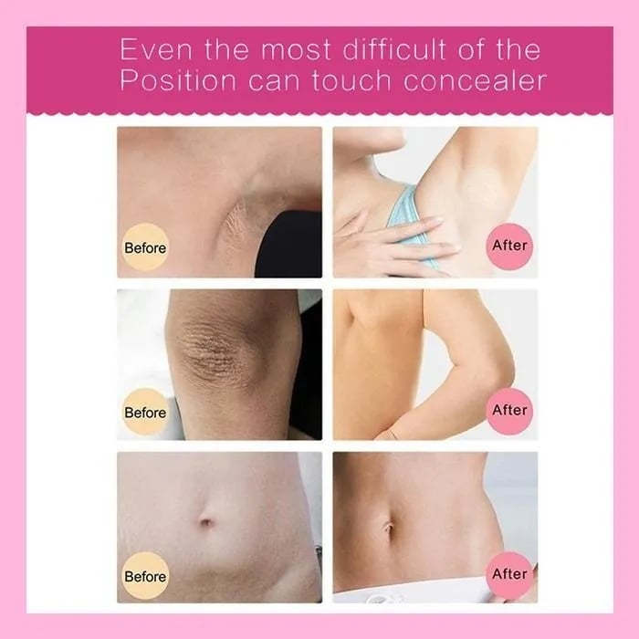 🔥Last Day 70%OFF🔥The Most Popular Whitening Cream
