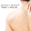 BENDCHARGE™ WipeOff Tags & Mole Remover