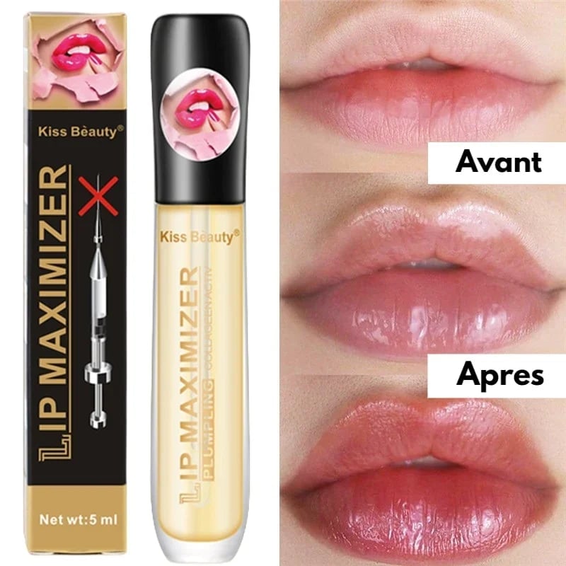 🔥Hot Sale 50% OFF-🔥- Vitamin E Lip Serum